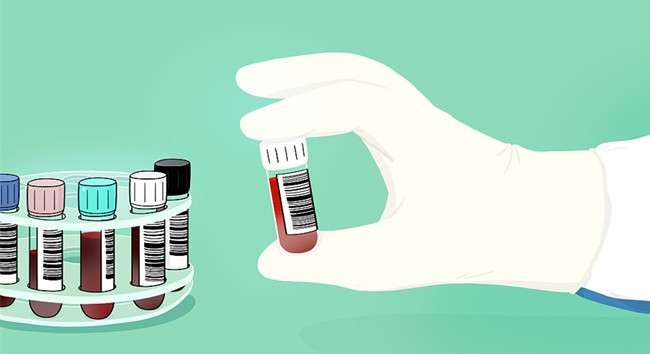 1595554213693878.jpg 進(jìn)口胎牛血清關(guān)